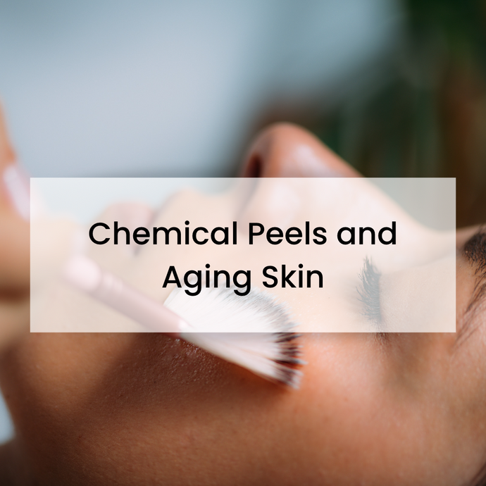The Benefits of A Chemical Peel Treatment on Aging Skin