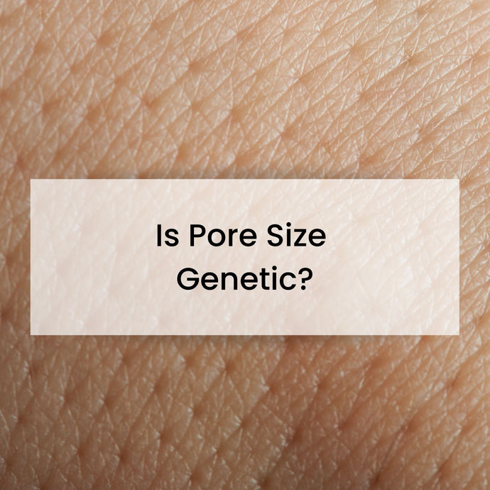 Is Pore Size Genetic?