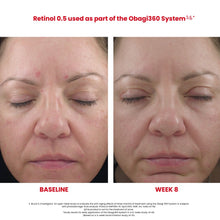 Load image into Gallery viewer, Obagi360 Retinol Cream Before and After by HOO Dermatology