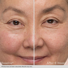 Load image into Gallery viewer, Obagi Nu-Cil Eyebrow Boosting Serum by HOO Dermatology Results