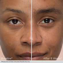 Load image into Gallery viewer, Obagi Nu-Cil Eyebrow Boosting Serum by HOO Dermatology Results