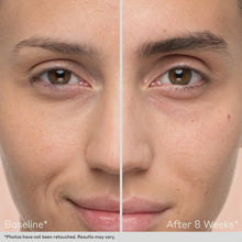 Load image into Gallery viewer, Obagi Nu-Cil Eyebrow Boosting Serum by HOO Dermatology Results