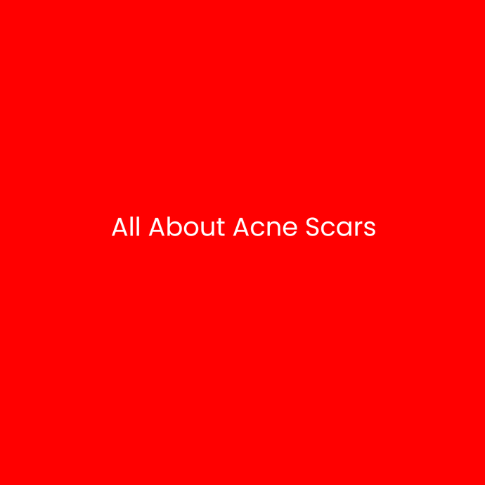 All About Acne Scars