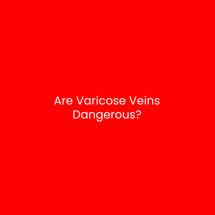 Are Varicose Veins Dangerous?