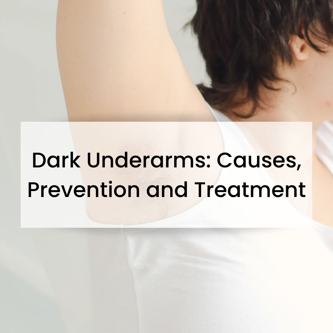 What causes Dark underarms, how to prevent and possible treatments