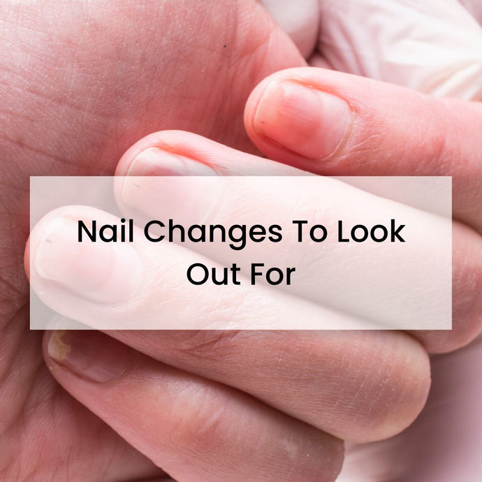 Nail Changes To Look Out For