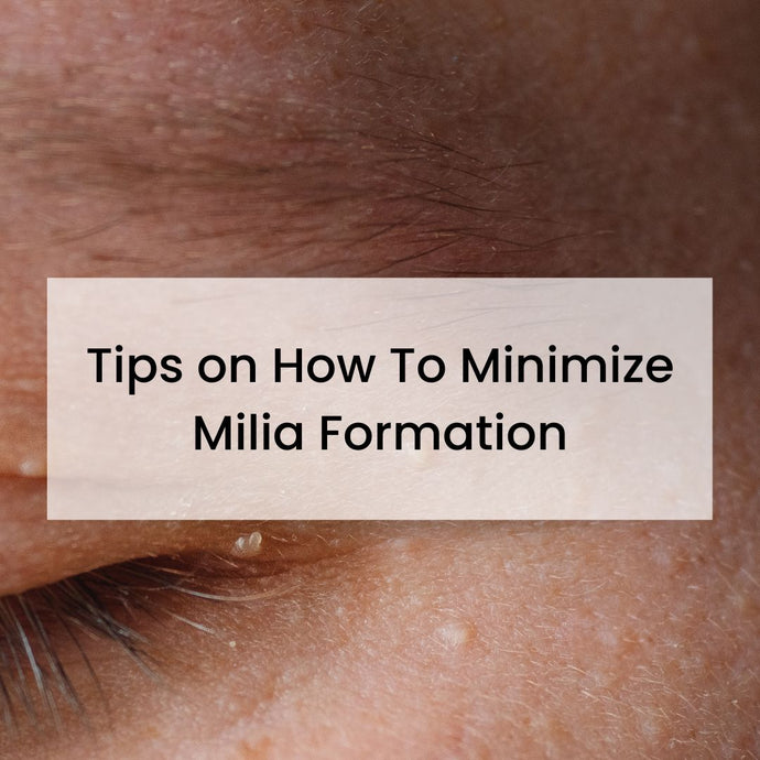 5 Tips on How To Minimize Milia Formation
