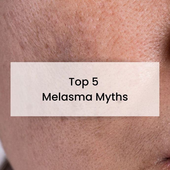 Top 5 Melasma Myths