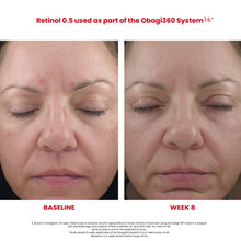 Load image into Gallery viewer, Obagi360 Retinol Cream Before and After by HOO Dermatology
