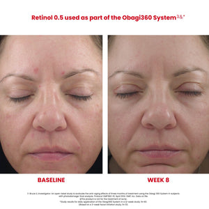 Obagi360 Retinol Cream Before and After by HOO Dermatology