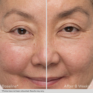 Obagi Nu-Cil Eyebrow Boosting Serum by HOO Dermatology Results