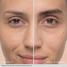 Load image into Gallery viewer, Obagi Nu-Cil Eyebrow Boosting Serum by HOO Dermatology Results
