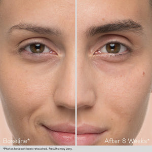 Obagi Nu-Cil Eyebrow Boosting Serum by HOO Dermatology Results